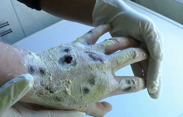 Blinda México fronteras para evitar llegada del krokodil