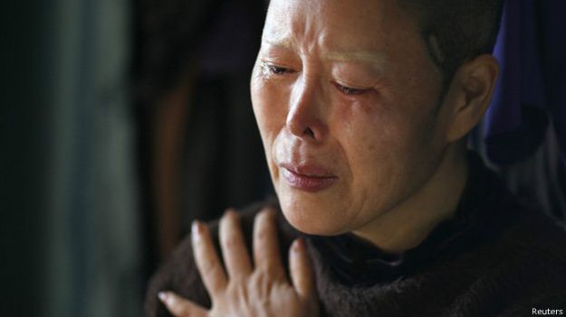 Los médicos convencieron a Kim Bok-Soon a someterse a 15 operaciones faciales. Los médicos convencieron a Kim Bok-Soon a someterse a 15 operaciones faciales.