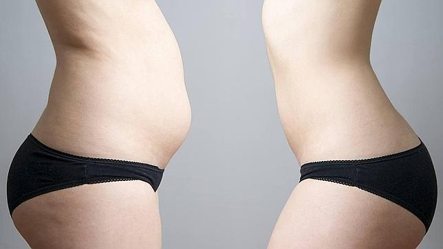 FOTOLIA Con los años se va acumulando grasa: el abdomen es uno de los depósitos de grasas en las mujeres