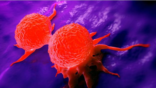 Los casos de cáncer de mama son mucho más comunes a partir de los 20 años de edad. Los casos de cáncer de mama son mucho más comunes a partir de los 20 años de edad.