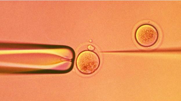 Las técnicas de fertilización in vitro han permitido a muchas parejas con problemas para concebir tener hijos.