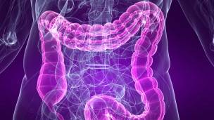 La comida basura es, según los expertos, lo que más daña nuestros intestinos. La comida basura es, según los expertos, lo que más daña nuestros intestinos.