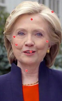 1. Se ha inyectado Bótox en la frente y el código de barras para suavizar ceño y labio de fumadora.