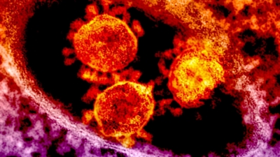 Imagen microscópica de una cepa de coronavirus.