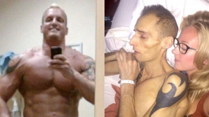 Dean Wharmby antes y después. El exceso de anabólicos y la comida hipercalórica arruinaron su hígado