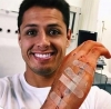 Así quedó la mano de “Chicharito” Hernández tras la cirugía. Estará dos semanas inactivo