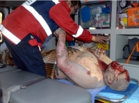 Continúan 18 personas graves; nueve de ellas son bebés