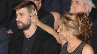 El truco con el que Shakira oculta su alopecia
