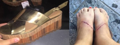 Las heridas causadas por unas sandalias de Zara revolucionan Facebook