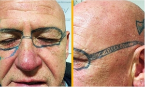 Despertó &#039;crudo&#039;... ¡y con unos lentes tatuados!