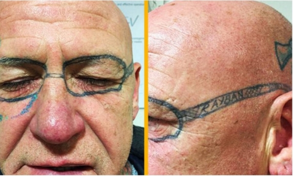 Despertó &#039;crudo&#039;... ¡y con unos lentes tatuados!