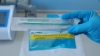 Los materiales para un kit de prueba rápida para el coronavirus (COVID-19) .