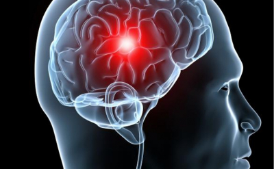 Un fármaco experimental llamado NVG-291-R publicado en la revista Cell Report promueve la reparación del sistema nervioso tras un ictus