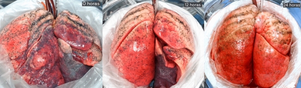 Consiguen recuperar pulmones humanos dañados tras conectarlos a cerdos vivos