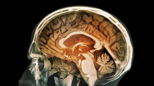 Es la primera vez que se encuentra evidencia de que partículas de la contaminación pueden llegar al cerebro.