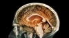 Es la primera vez que se encuentra evidencia de que partículas de la contaminación pueden llegar al cerebro.