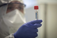 Prueba de coronavirus.
