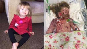 Faye Burdett luchó sólo once días contra la meningitis. Sus padres decidieron que muriera en paz
