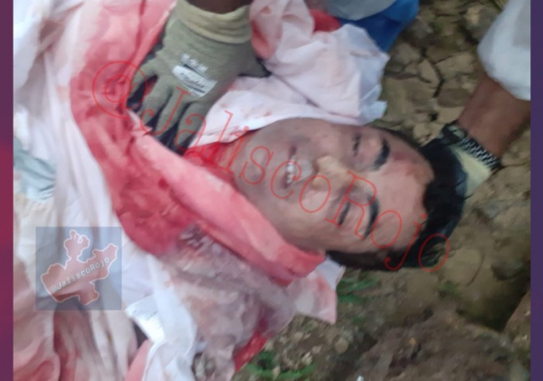 Tomé Velázquez fue agredido a tiros en el Bulevar Francisco Medina Ascencio, frente a la zona militar, en Puerto Vallarta, la madrugada de este domingo