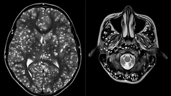 ESIC Medical College and Hospital