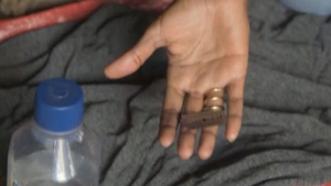 El lugar y la cuchilla de afeitar que las &quot;cortadoras&quot; utilizan para realizar la mutilación genital a niñas africanas.