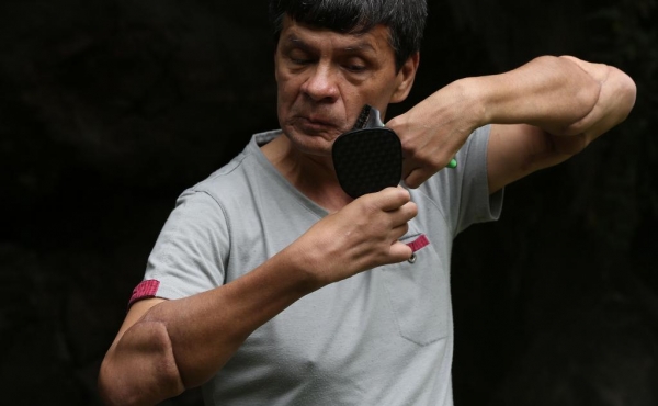 Tras trasplante de brazos &quot;ahora disfruto ser portero&quot;