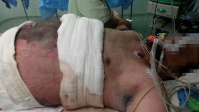 Daniel Guevara, el paciente de Juan Arturo Hernández Montejano.