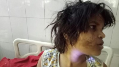 El estado de salud de la niña, que tiene problemas para comunicarse, está mejorando