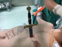 Imagen del joven en el quirófano antes de ser operado en el centro hospitalario.