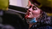 Una joven herida que perdió un ojo por un disparo de los Mossos d&#039;Escuadra durante unas protestas. Barcelona, 16 de febrero de 2021.
