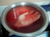 El catedrático es atendido en un hospital privado, donde médicos especialistas le realizaron una cirugía para tratar de injertarle de nuevo su mano.