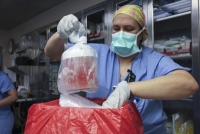 La primera persona que recibió un trasplante de riñón de cerdo genéticamente modificado muere casi dos meses después