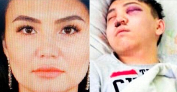 Zhanna Nurzhanova no toleró saber que su novio tenía una amante y decidió cortarle los testículos