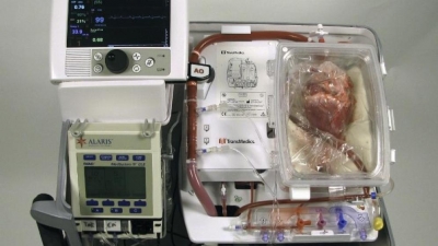 Máquina desarrollada por TransMedics que permite el trasplante de corazón desde un donante fallecido