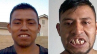 El antes y después del accidente de Luis Loza