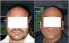 Los aprehendidos se identificaron como José Ortega “N”, de 35 años, y David “N”, de 39 años; fueron llevados ante un agente del Ministerio Público para declarar.