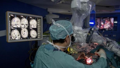 Operación de turmor cerebral en los quirófanos híbridos de la Clínica de la Universidad de Navarra