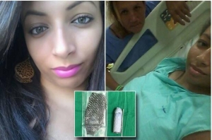 Una brasileña nació sin vagina y se la reconstruyeron con piel de pescado (FOTOS)