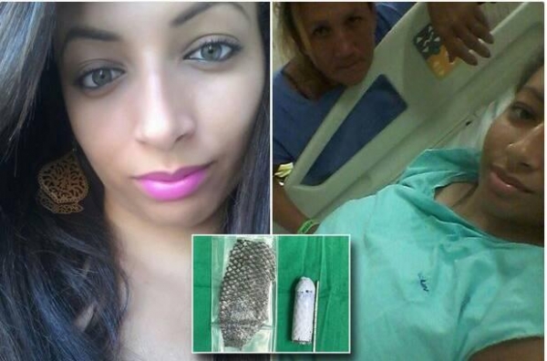 Una brasileña nació sin vagina y se la reconstruyeron con piel de pescado (FOTOS)