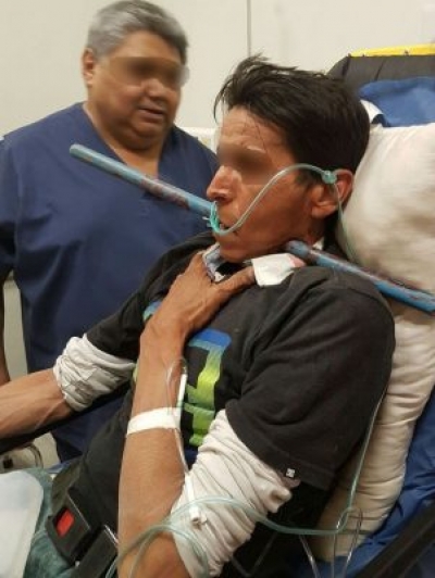 Palo de recogedor le atravesó la cara, al caer encima