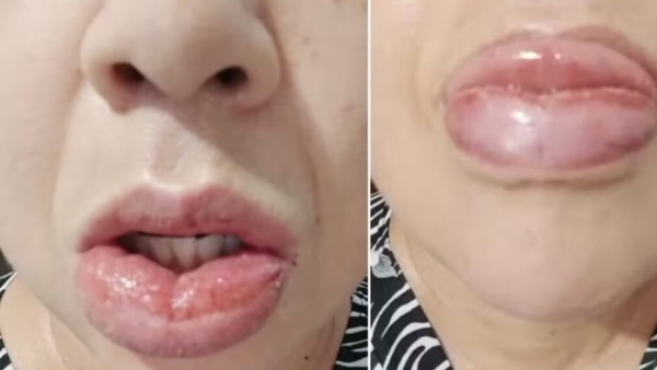 Dejarán de fabricar una pasta dental Colgate después de miles de denuncias por reacciones adversas