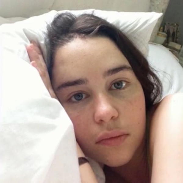 La actriz de &quot;Juego de Tronos, Emilia Clarke, revela imágenes de su estadía en el hospital tras sufrir un aneurisma cerebral