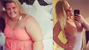 La impactante transformación de una mujer que padecía obesidad mórbida
