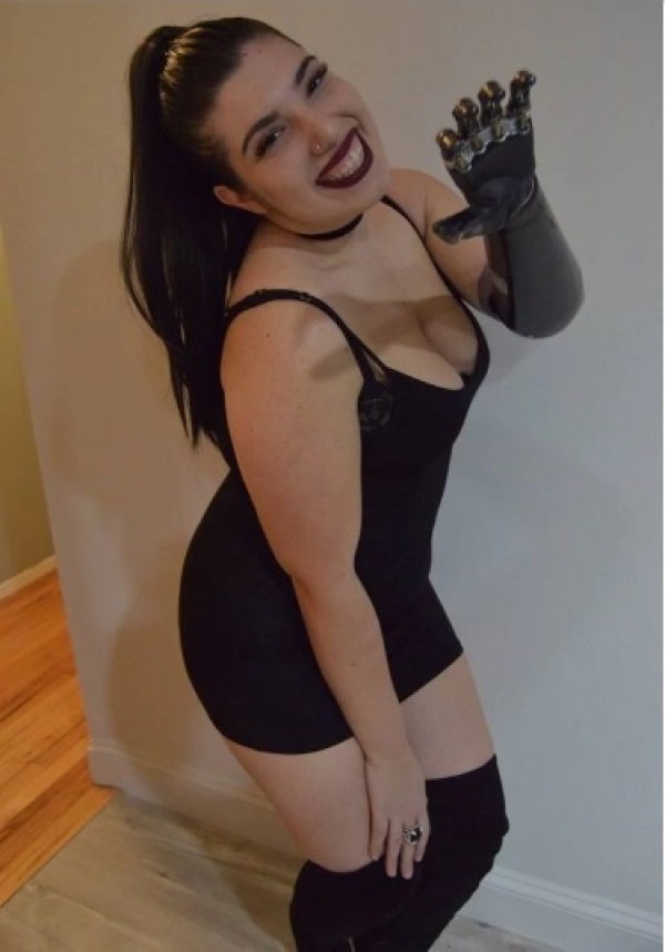 Testimonio: así es salir de fiesta cuando sólo tienes un brazo