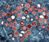 Micrografía electrónica de transmisión coloreada de partículas de viruela del mono (rojo) encontradas dentro de una célula infectada (azul) cultivadas en laboratorio en el Centro de Investigación Integrada (IRE, por sus siglas en inglés) del Instituto Nacional de Alergias y Enfermedades Infecciosas (NIAID, por sus siglas en inglés) , en Fort Detrick, Maryland.
