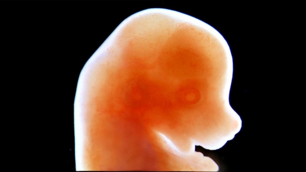 Un embrión de ratón de 13 días de edad